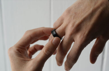 Samsung Galaxy Ring స్వెల్లింగ్ ఘటన; యూజర్ హాస్పిటల్కి